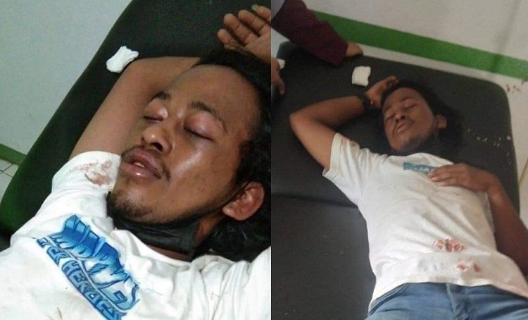 Depian Basri (22), Warga Kabupaten Maluku Barat Ddaya (MBD), Provinsi Maluku, Jadi Korban Penganiayaan Oknum Anggota TNI AD dari Koramil Tepa,.